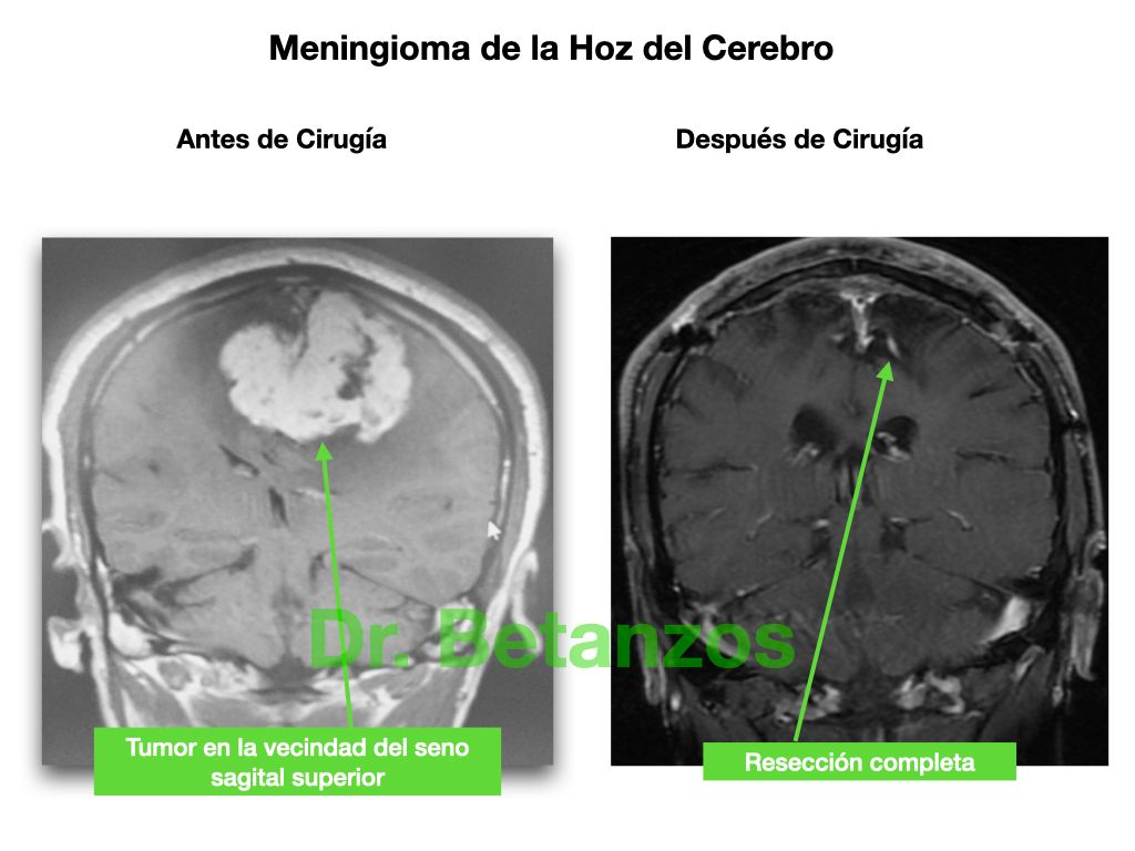 Aleixandre Betanzos Villegas-10
