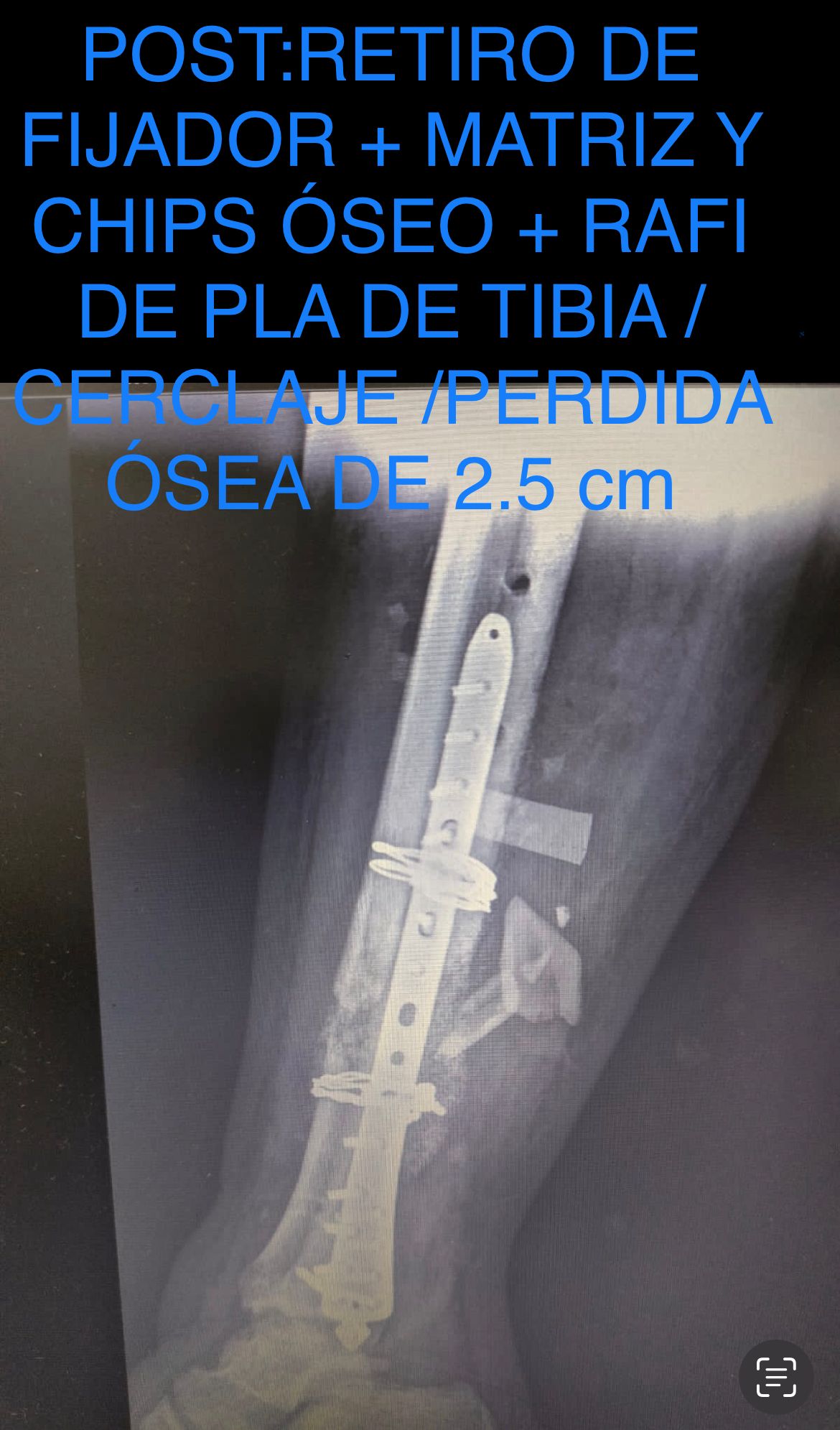 Emmanuel Bolaños Cortes-17