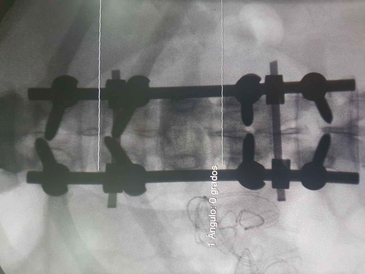Oswaldo Caldera Barbosa-5