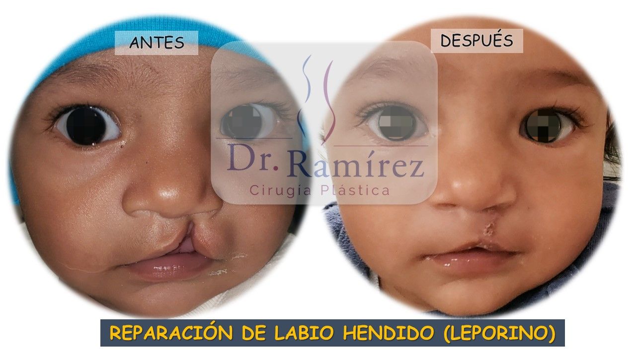 Edgar Ramírez López-113