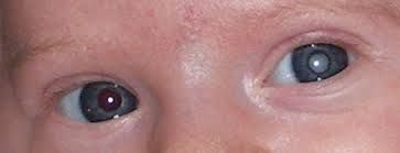 Rosa Elena De La Torre Castro-26