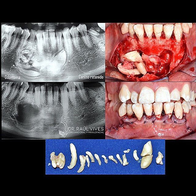 Raúl José Vives Serrano-6