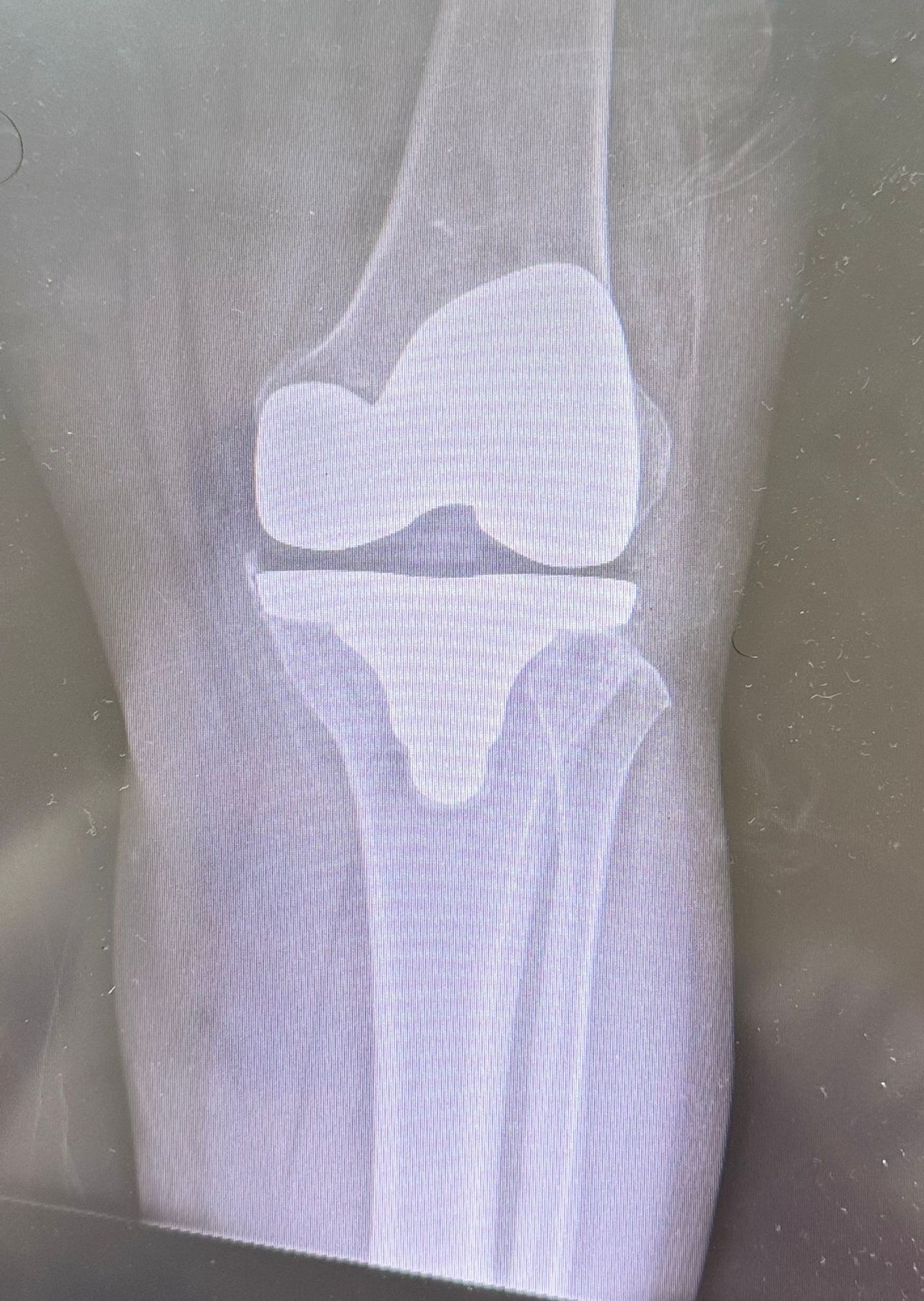 Ana Judith Jhotzely Lozano Reyes-1