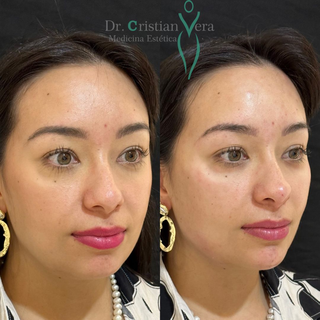 Cristian Eduardo Vera Nuño-5