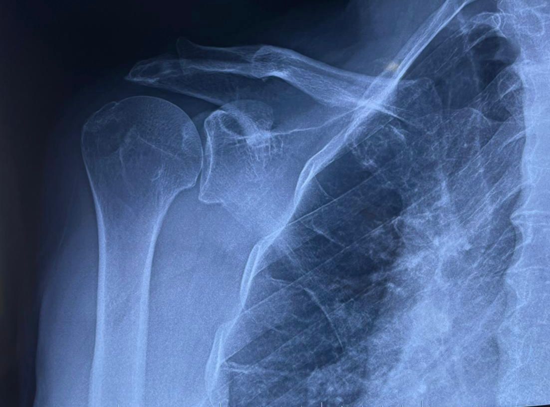 Josmar Adrián Lopez Eng-2