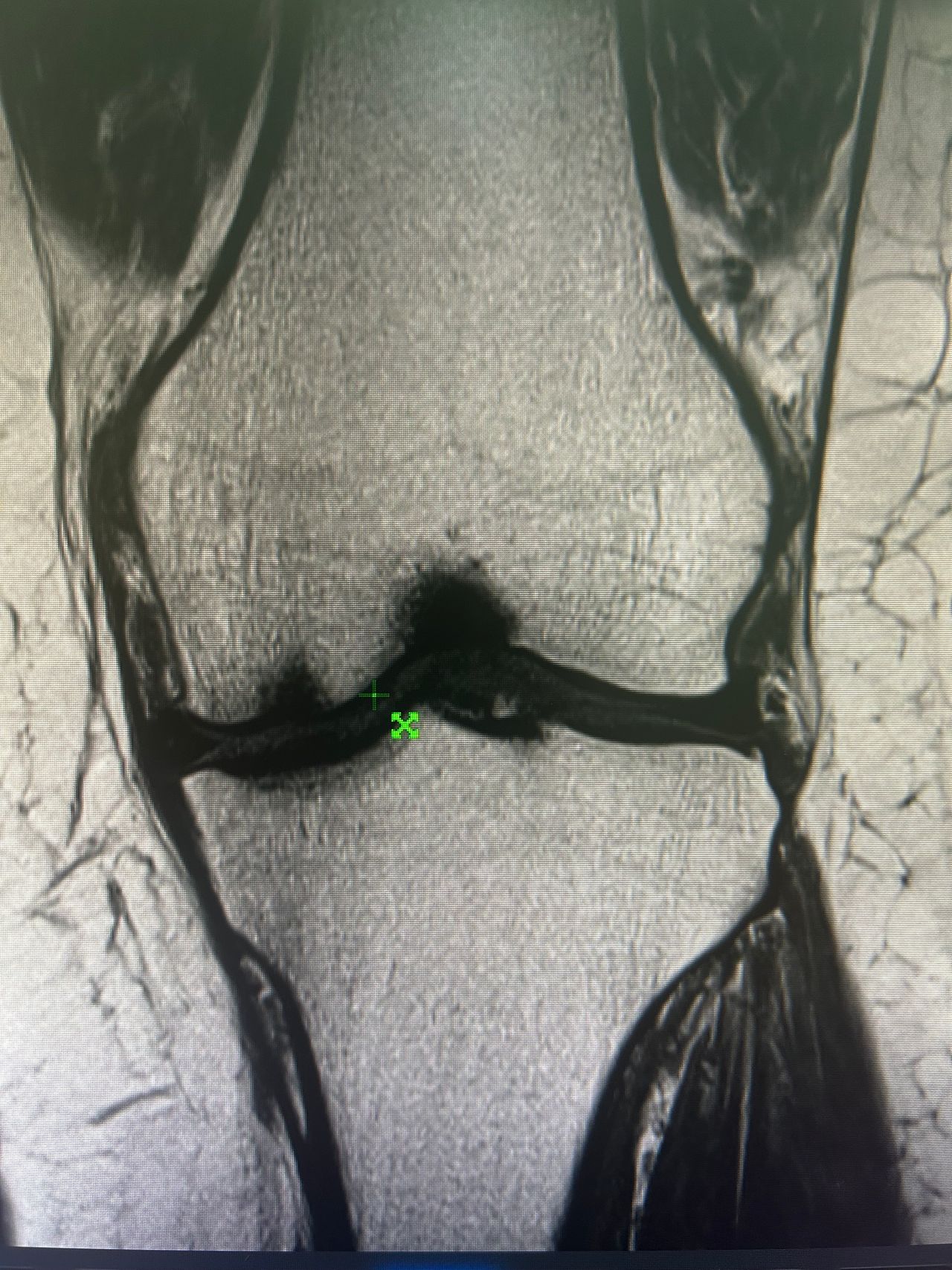 Francisco Avila Zapata-1