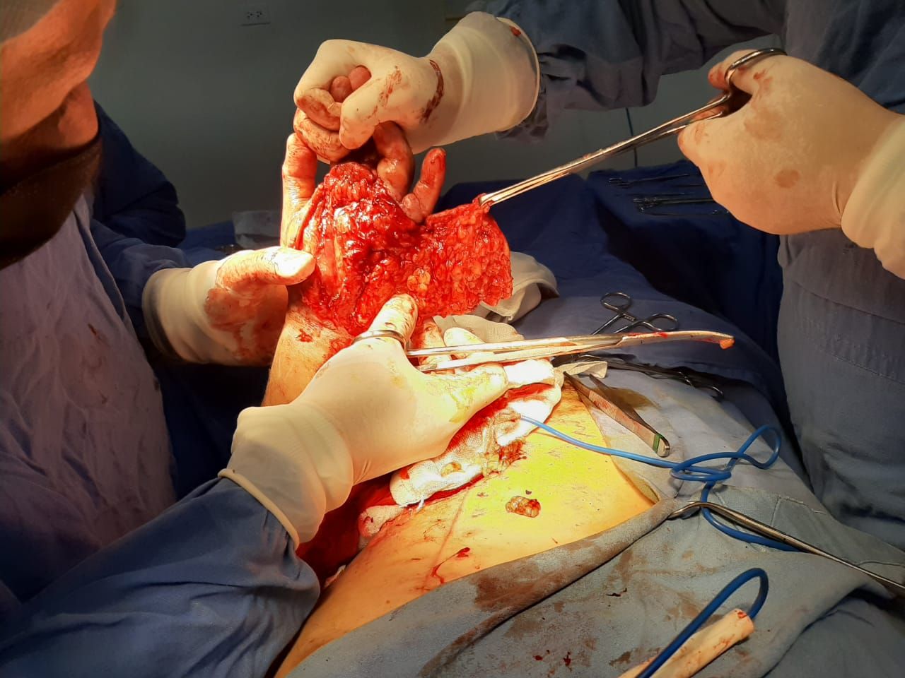 Federico Quintana De La Rosa-52