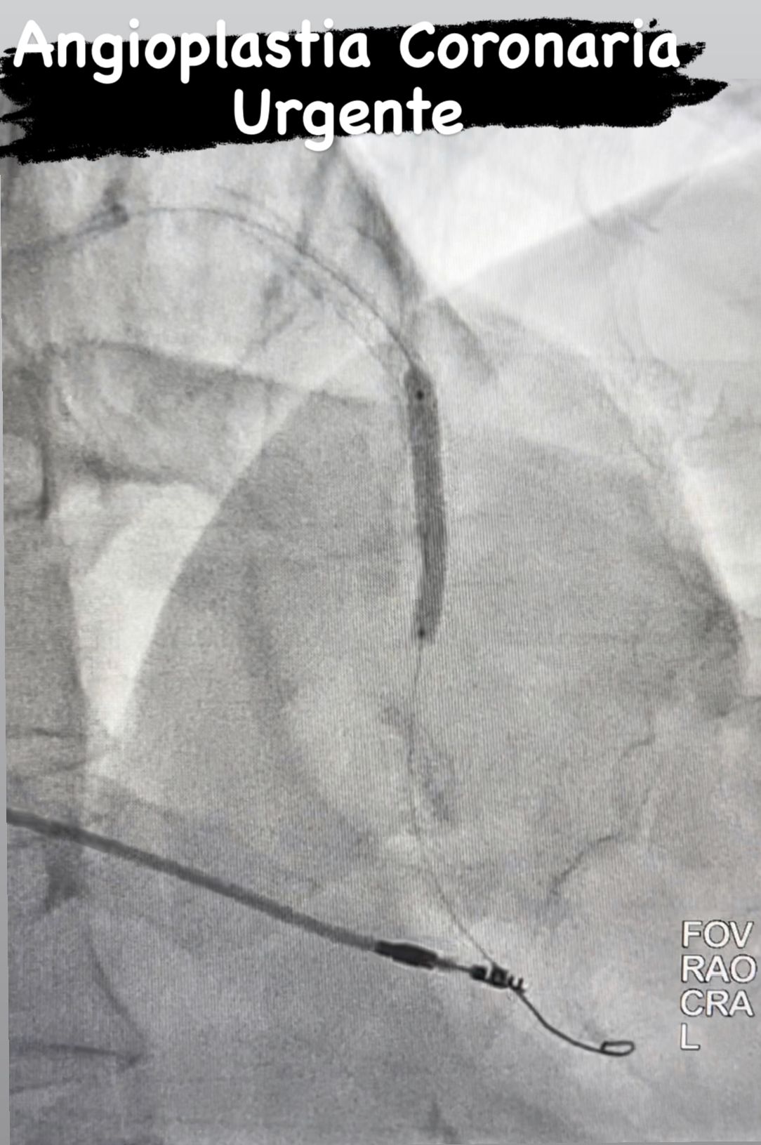 Abdón Ávila Chávez-30