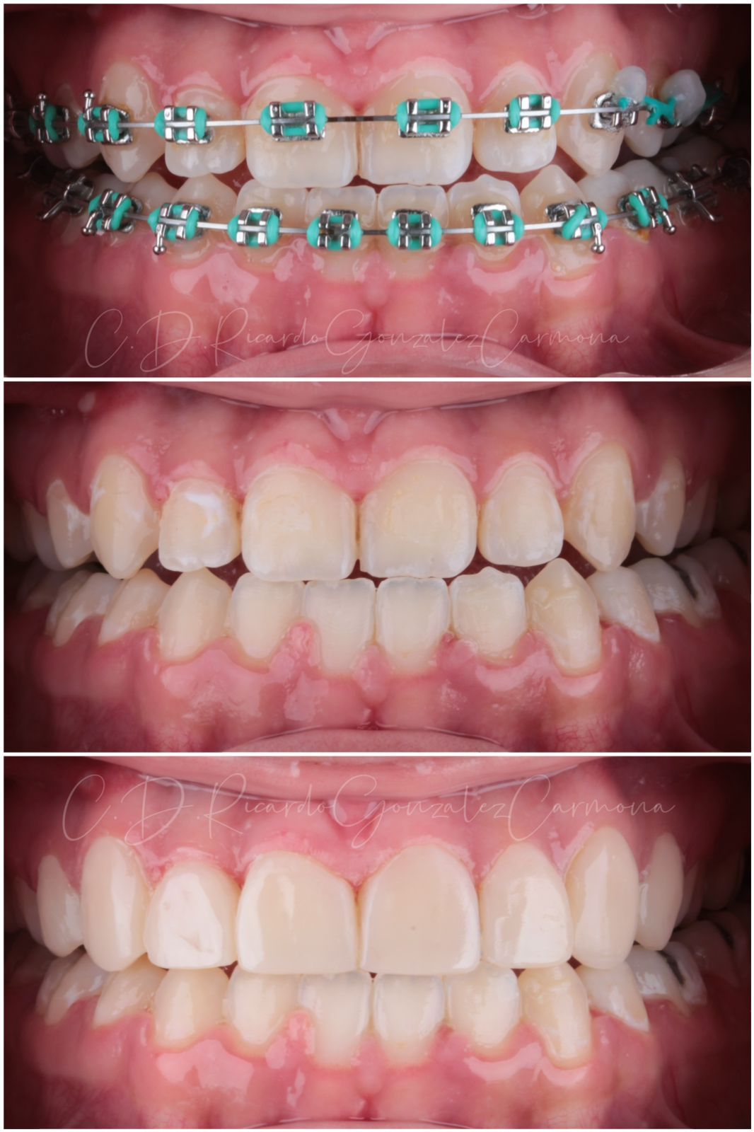 Alicia Carmona López-15