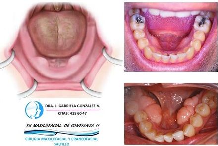 Laura Gabriela González Valdéz-56