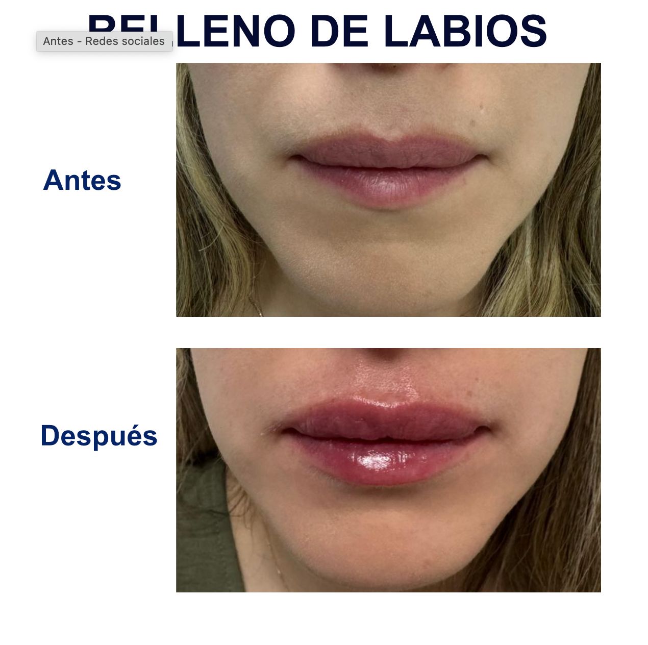 Itzel Anayn Flores Reyes-22