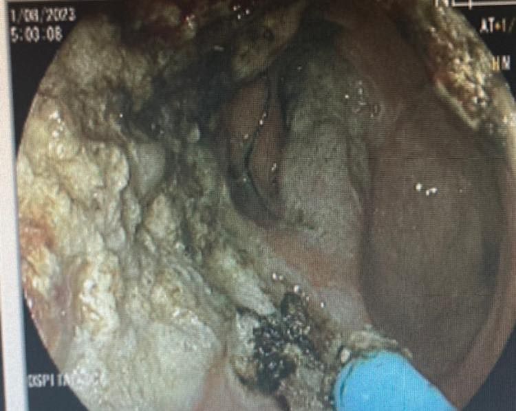 J. César Reyes Vásquez-27