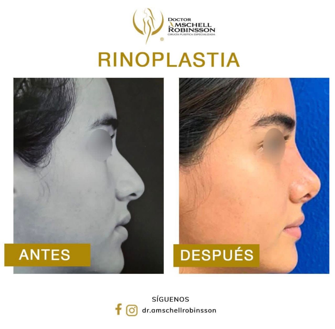 Amschell Robinsson-15