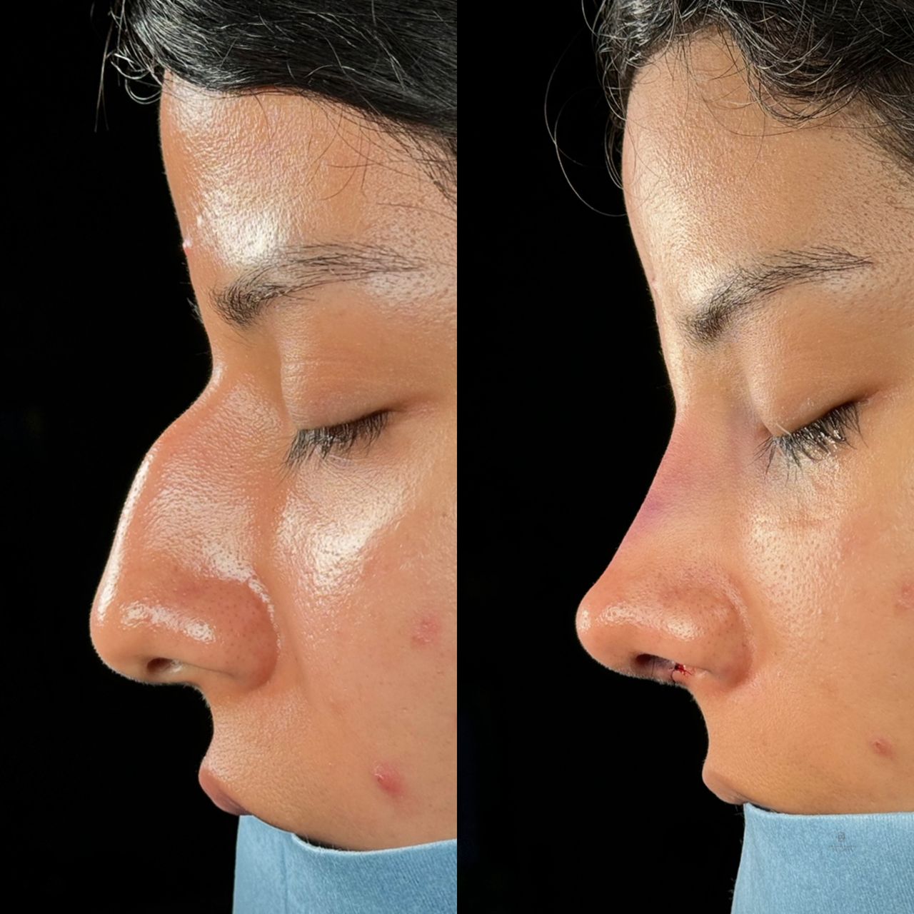 Angel Castro Urquizo-4