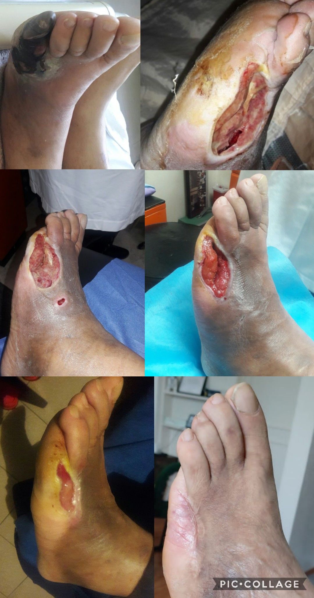 Deni Martínez Gama-10