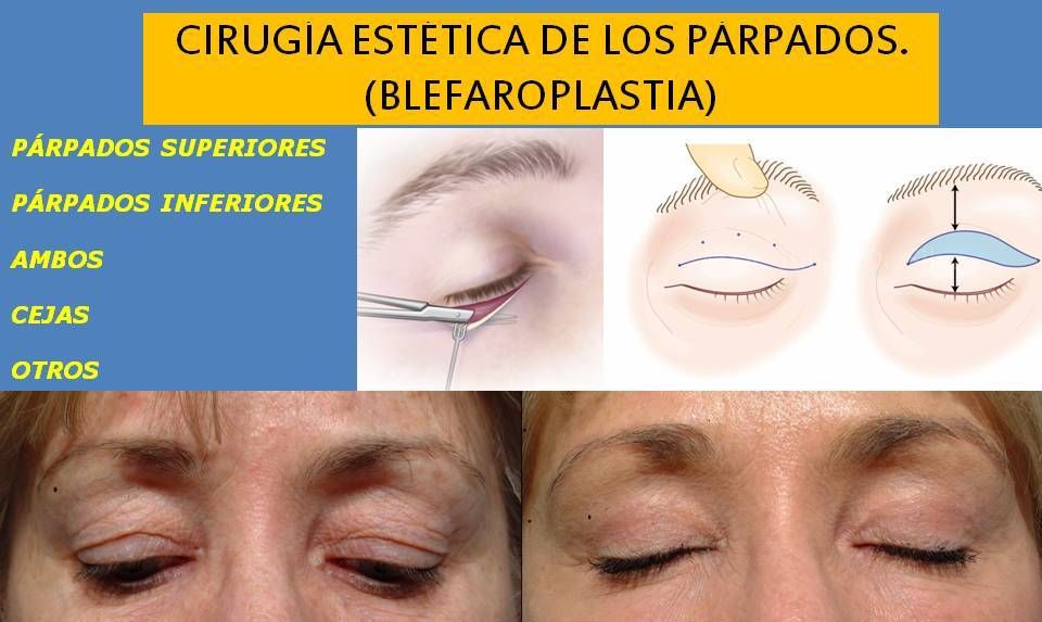 Armando Capote Cabrera-3