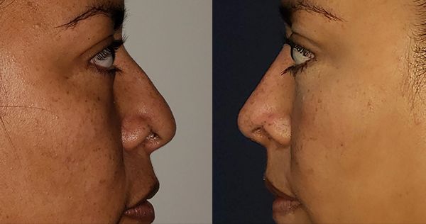 Edgar Ernesto Torres Mejía-35