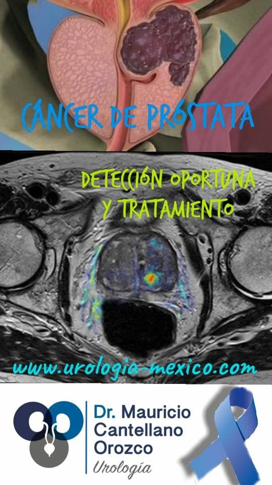 Mauricio Cantellano Orozco-11