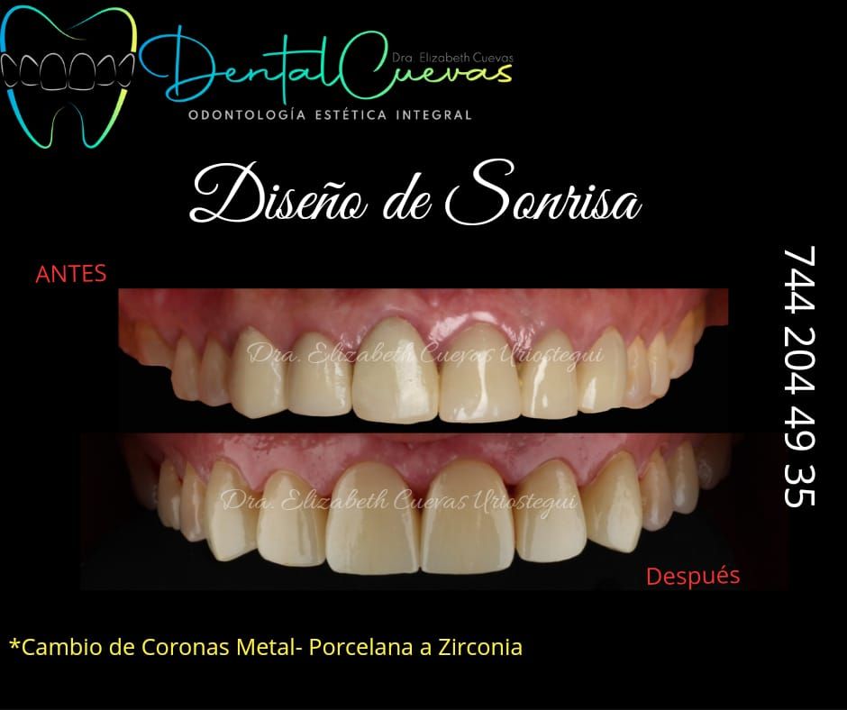 Elizabeth Cuevas Uriostegui-3