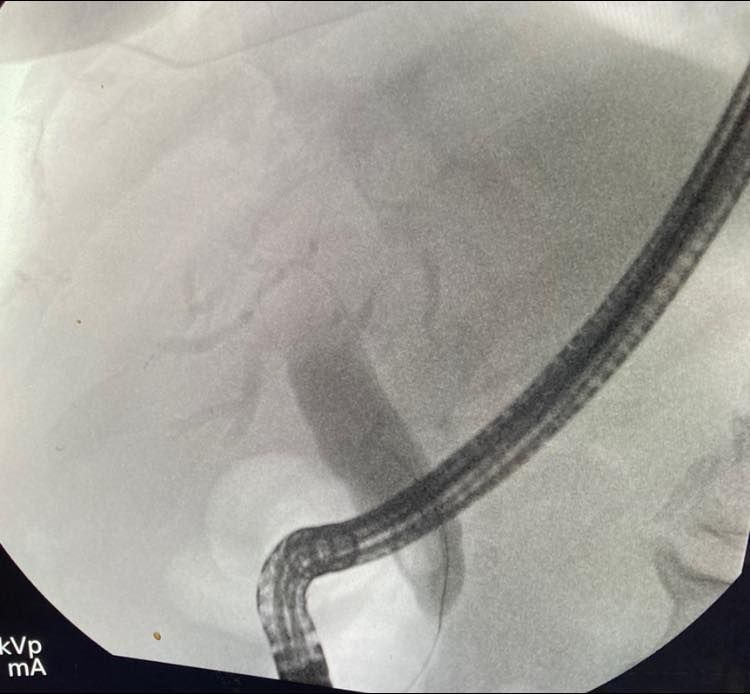 J. César Reyes Vásquez-11