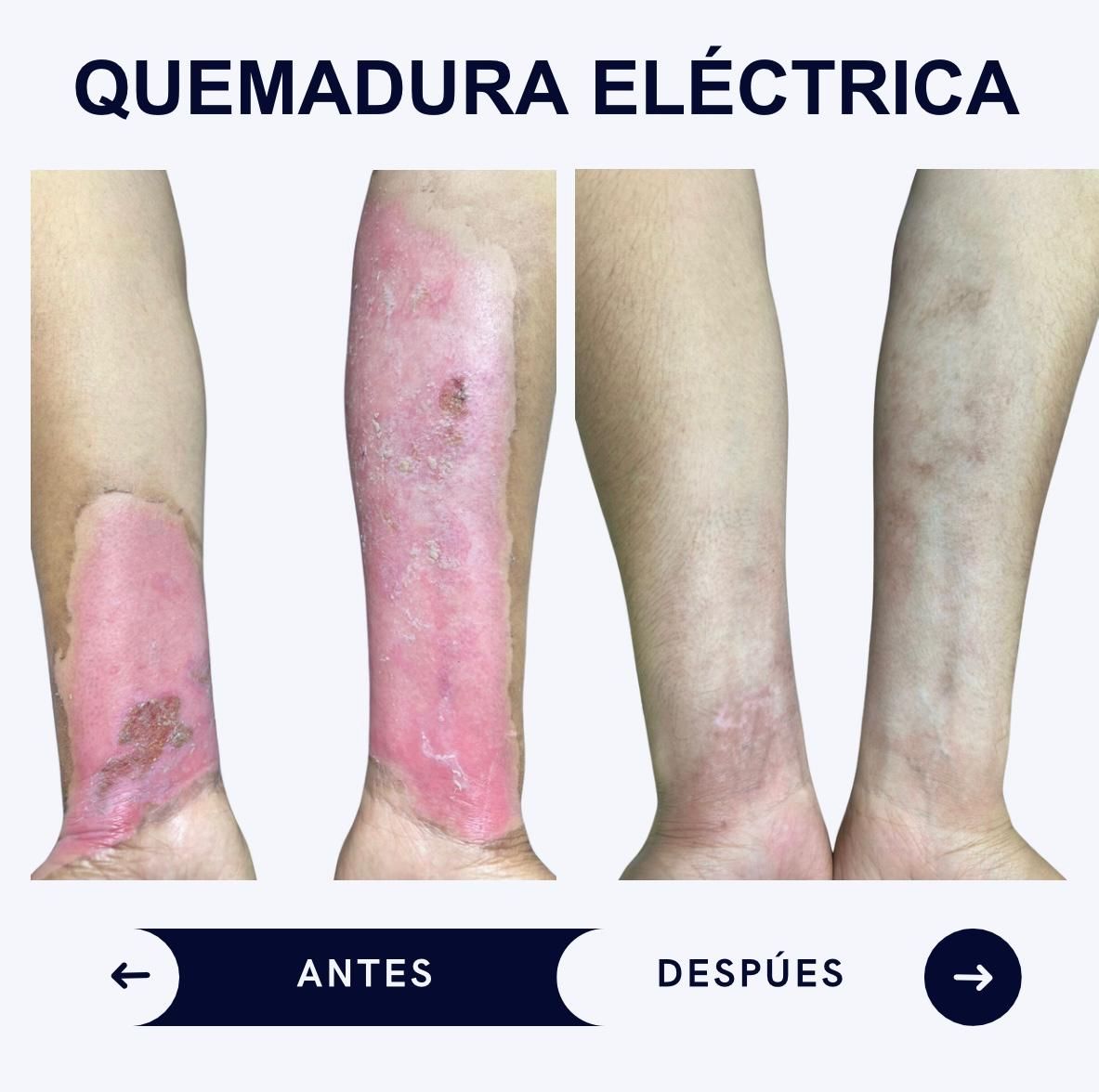 Itzel Anayn Flores Reyes-31