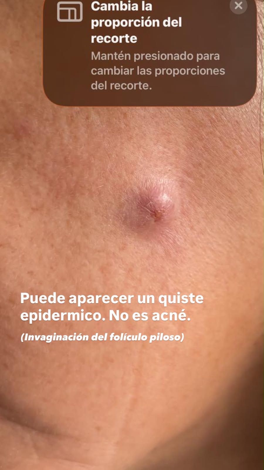 Patricia Alfaro Ledesma-11