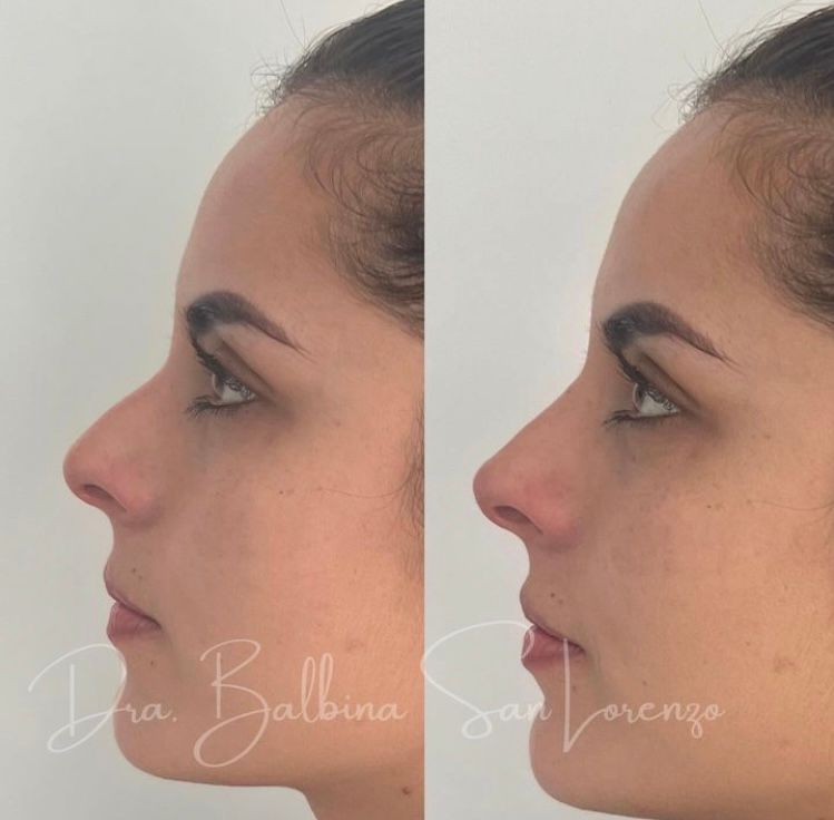 Balbina San Lorenzo Diaz-2