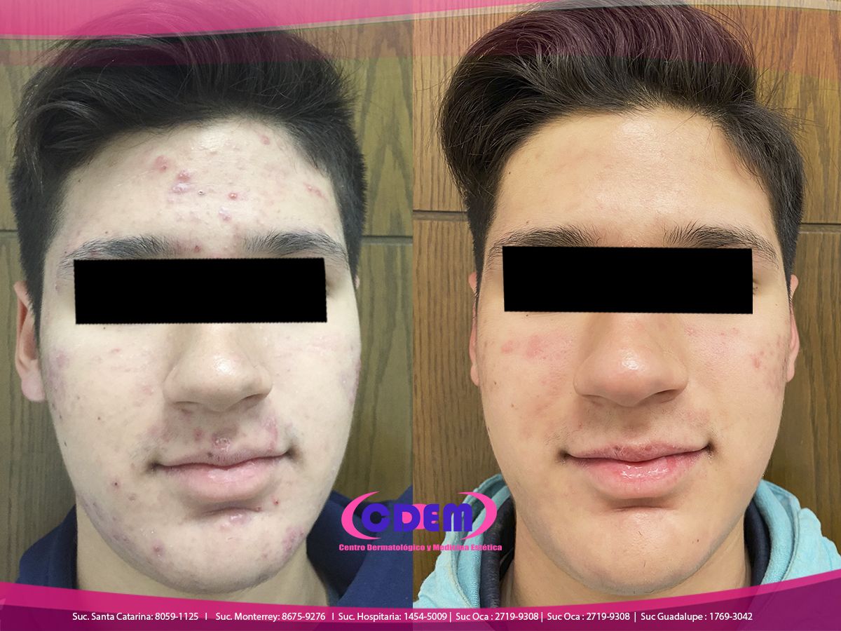 Mercedes Fernández Reyes-8