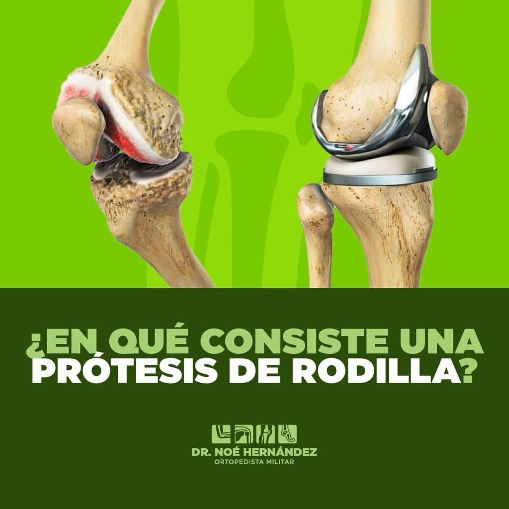 Noé Hernández Gómez-3