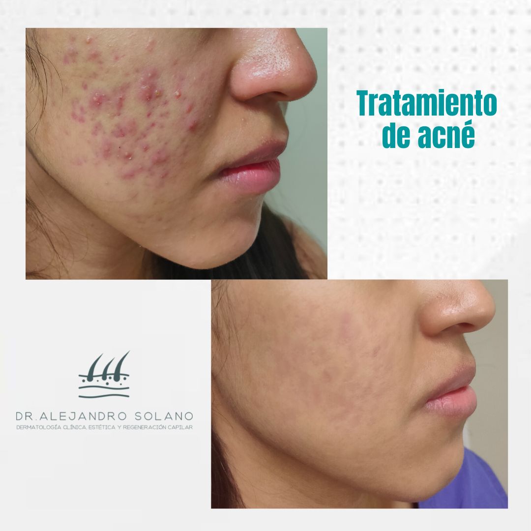 Oscar Alejandro Solano Anguiano-10