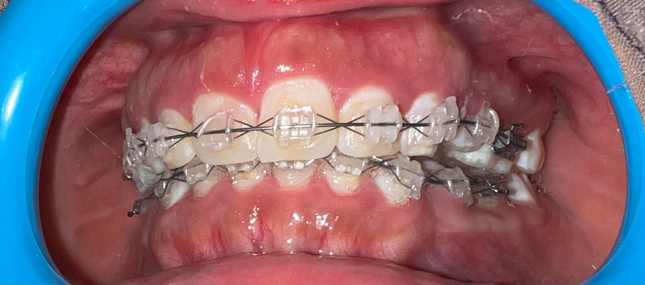 Oswaldo Sanchez Gonzalez-4