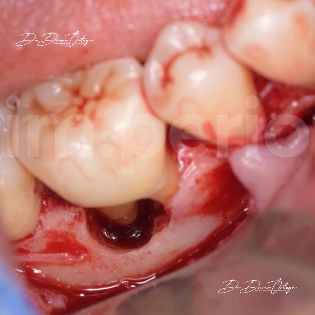 Dario Ortega Aceves-33