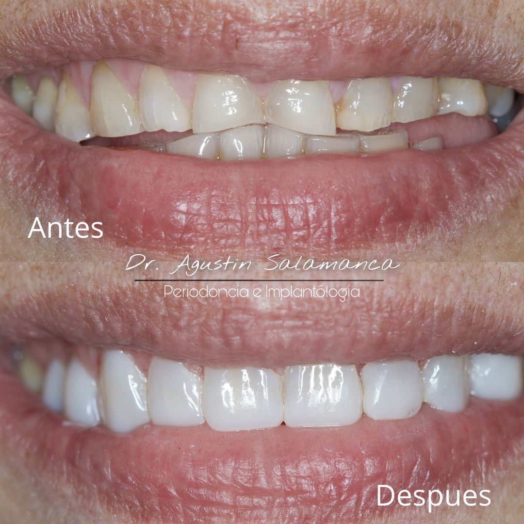 Agustin Salamanca Tapia-14