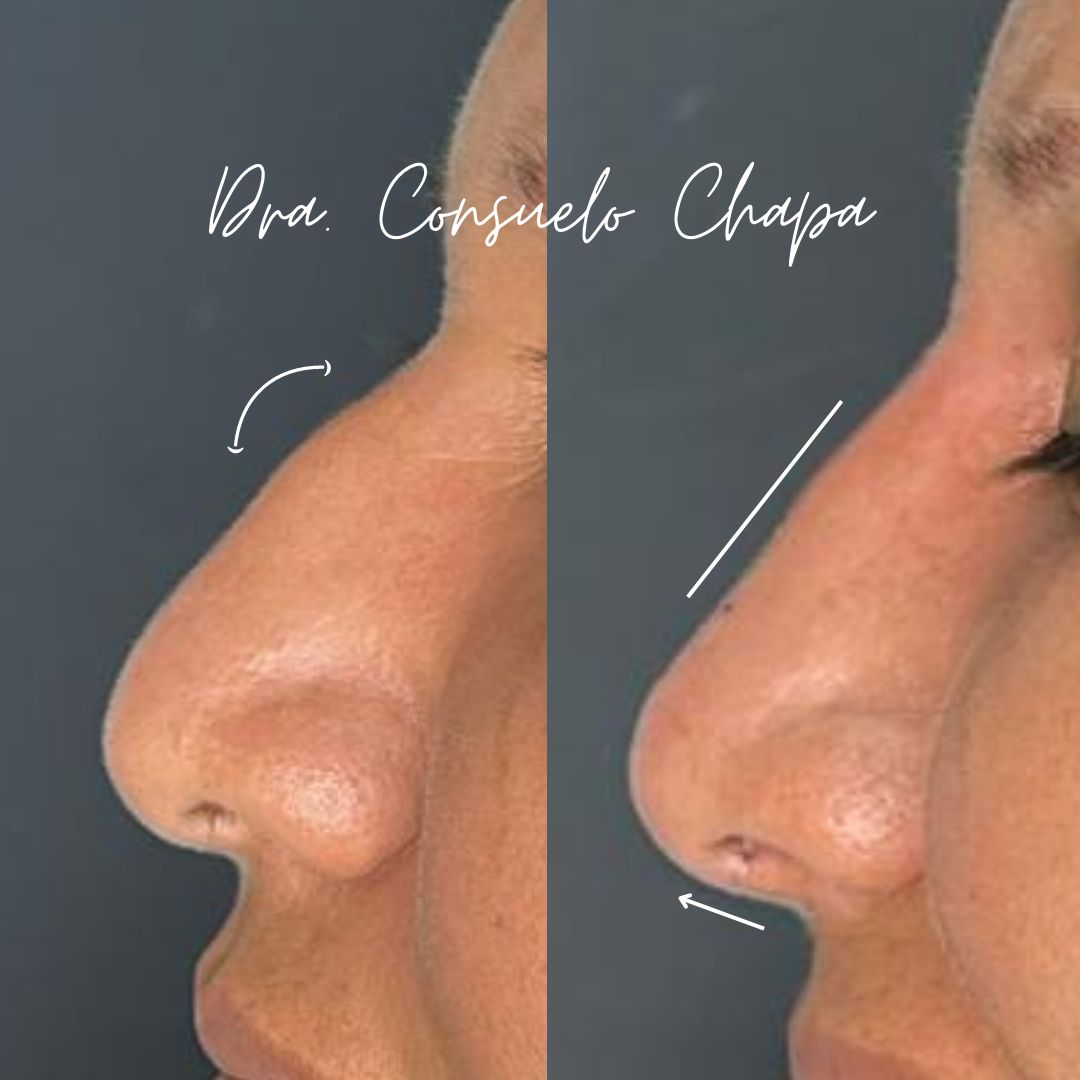 Consuelo Chapa Garza-6