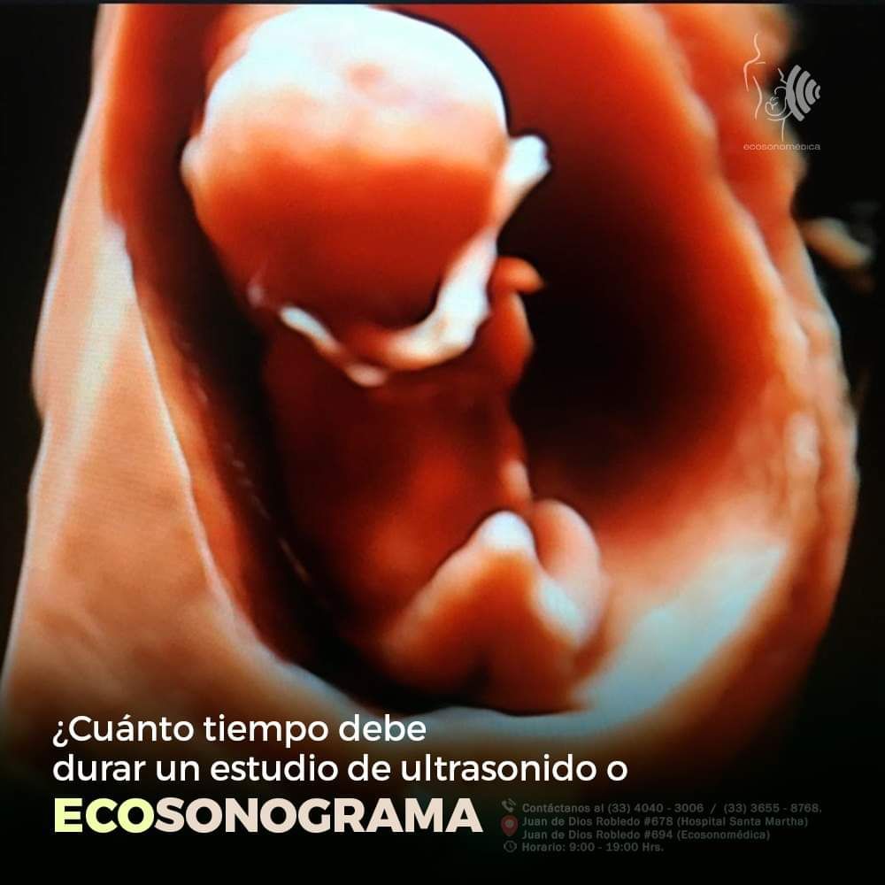 Héctor Bernardo Acevedo Manrique-26