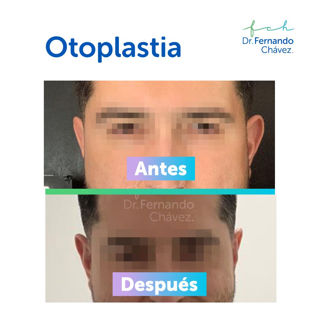 Fernando Chávez Osorio-24