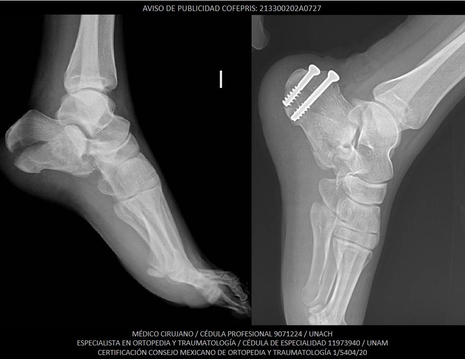 Luis Castañón Robles-15
