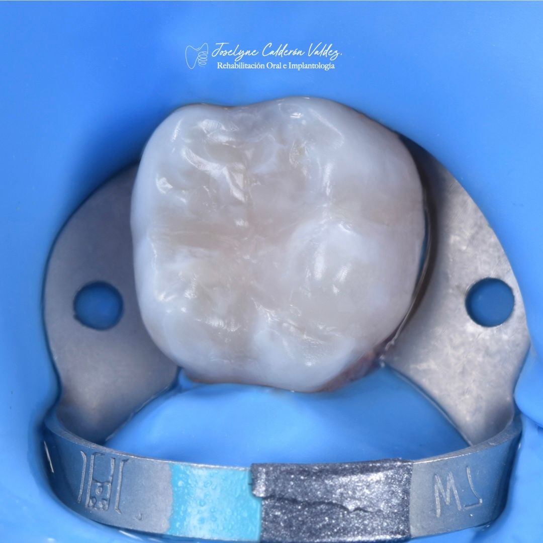 Joselyne Calderón Valdez-11