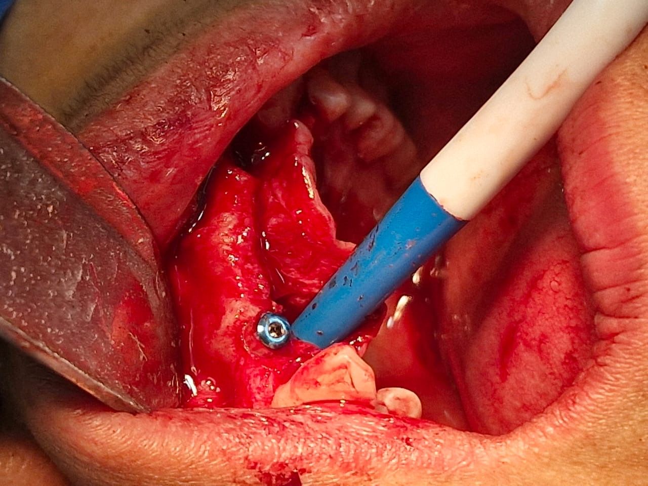 Jair Contreras García-49