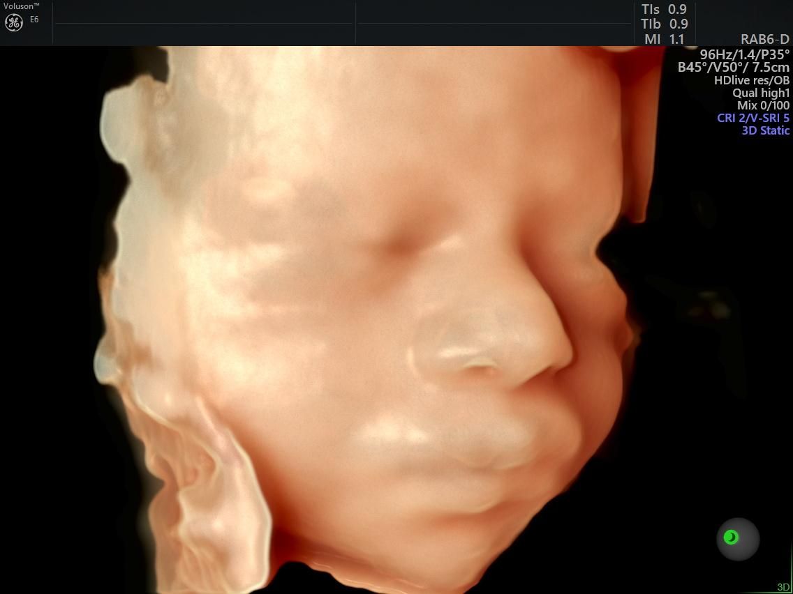 Jristos Jorge Castillo Ayala-4