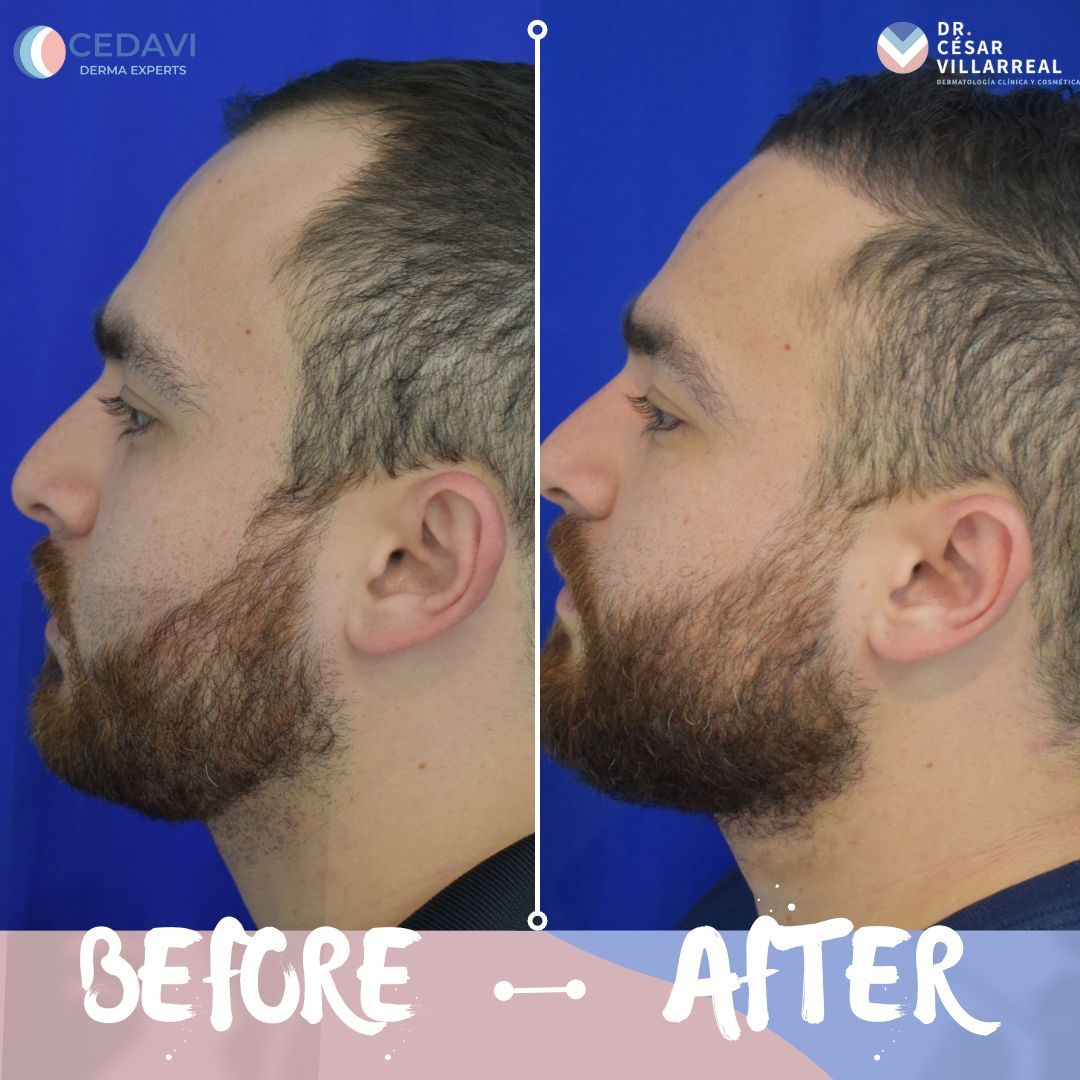 César Daniel Villarreal Villarreal-24