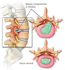 Roberto Gomez Raygoza-17