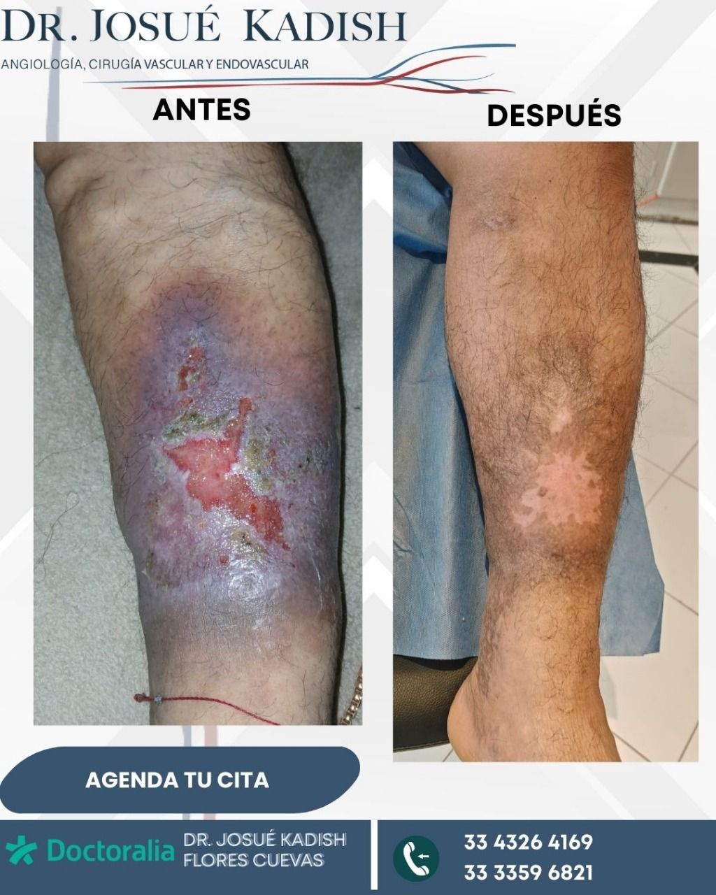 Josue Kadish Flores Cuevas-5