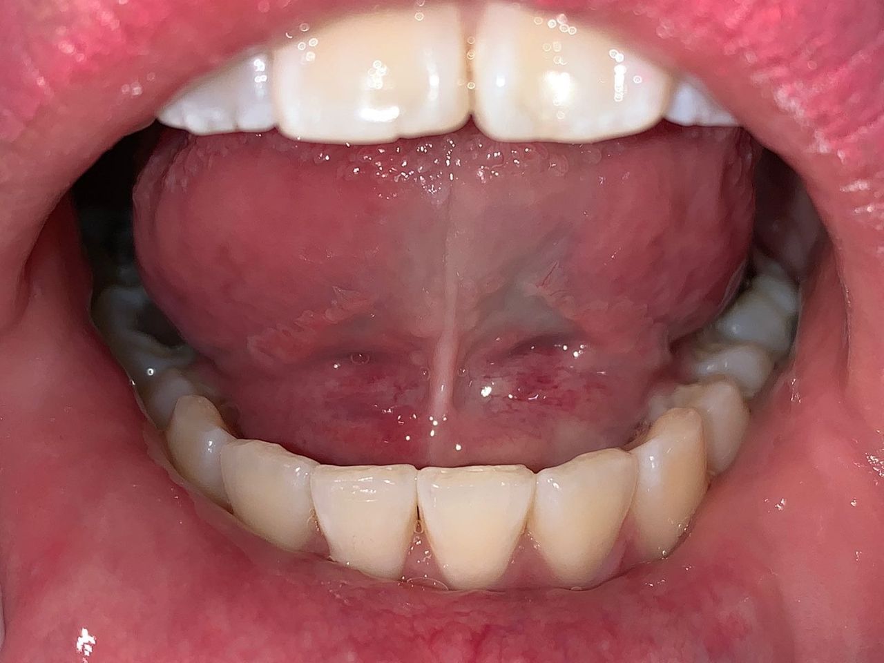 Fernando Olivier Victoriano-3