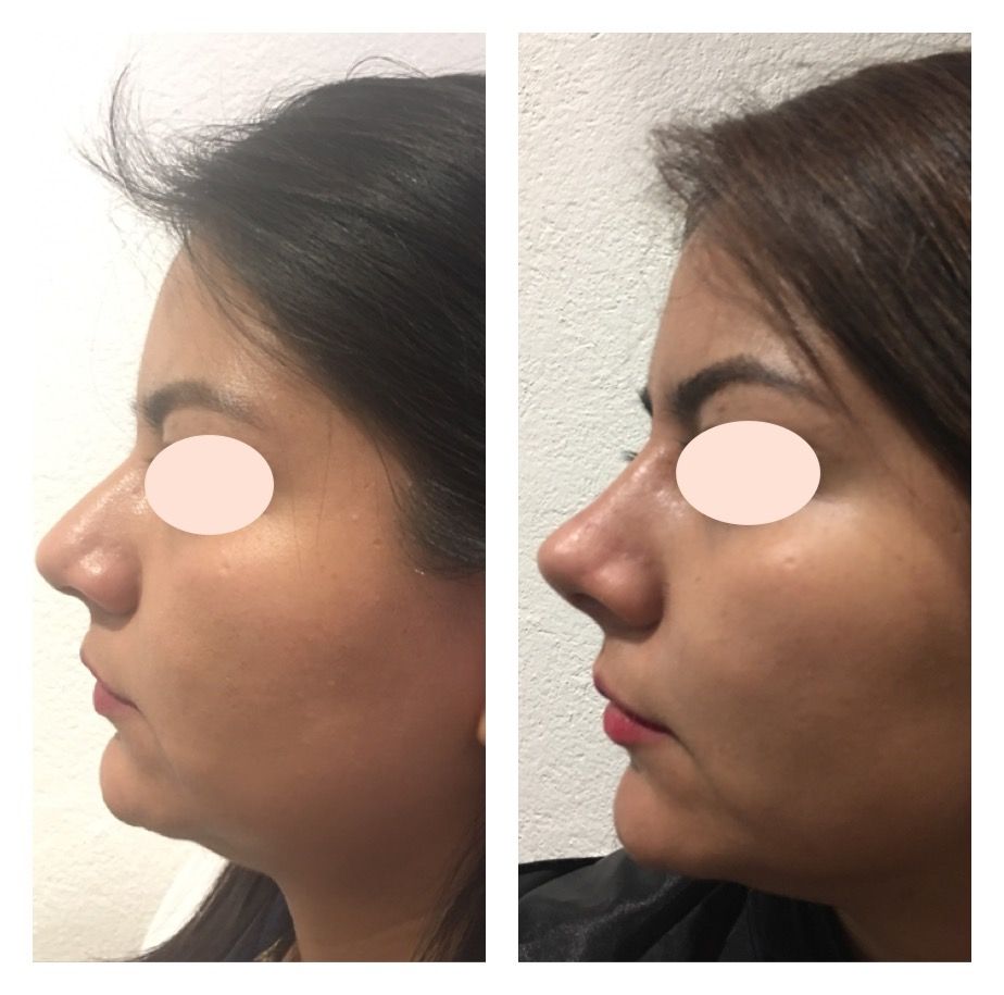 Carola Berenice Curiel Davalos-46