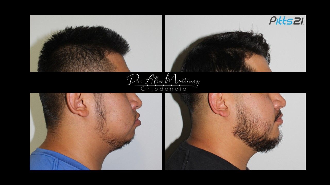 Alejandro Martínez Hernández-16