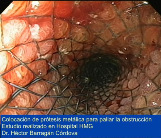 Héctor Hugo Barragán Córdova-3