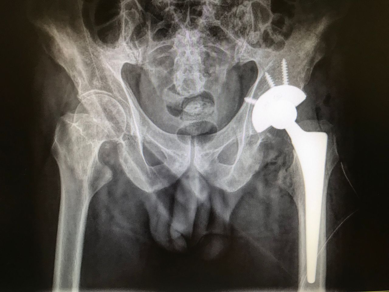 Carlos Alberto Lázaro Cubría-11