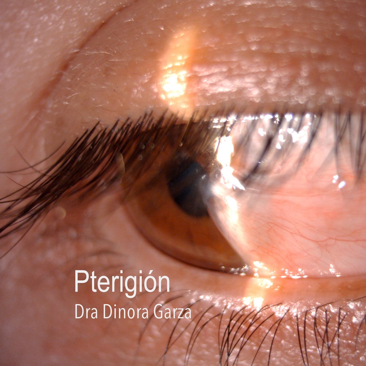 Dinora Garza Leal-28