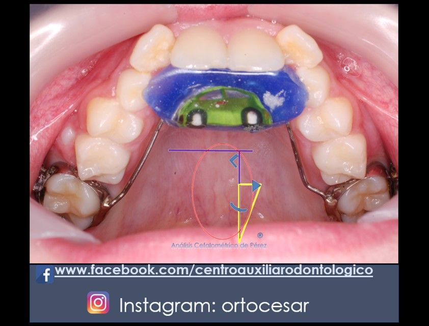 César Augusto Pérez Córdova-40
